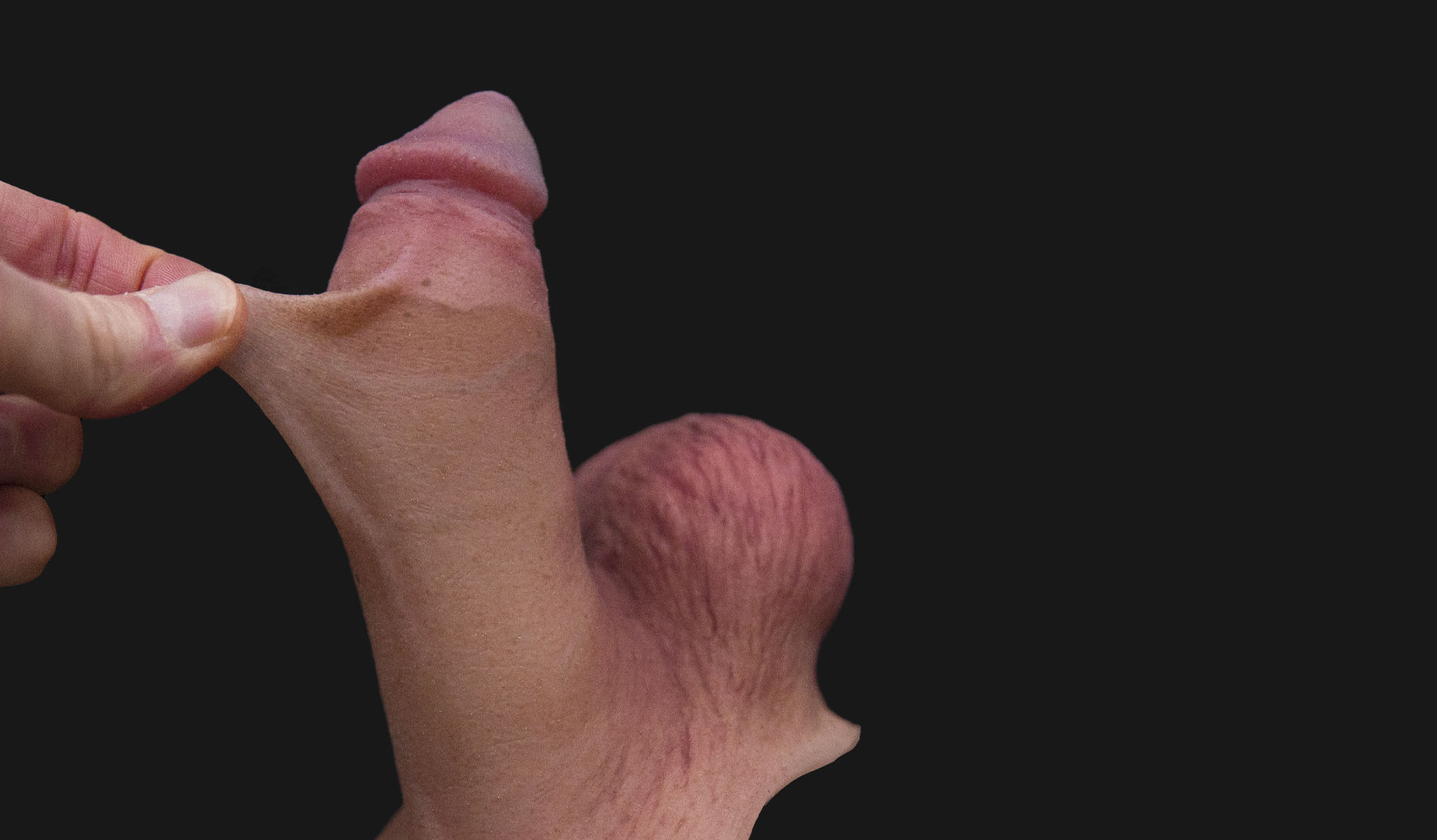 fingers pulling up the skin to demonstrate the moveable skin feature
